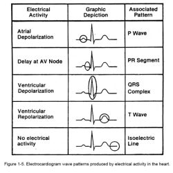 Lesson 11.2 identifying arrhythmia patterns