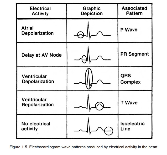 Lesson 11.2 identifying arrhythmia patterns